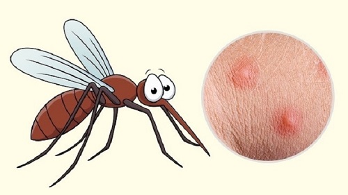 Cách tốt nhất để hạn chế tình trạng này là hãy áp dụng các biện pháp phòng tránh muỗi cho bản thân.